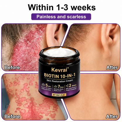 Made and Shipped from USA✨Kevrai® Biotin 10-in-1 Skin Restoration Cream🍀