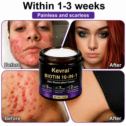 Made and Shipped from USA✨Kevrai® Biotin 10-in-1 Skin Restoration Cream🍀