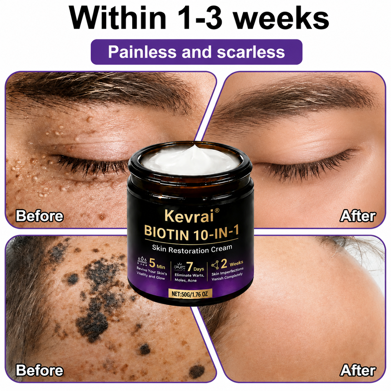 Made and Shipped from USA✨Kevrai® Biotin 10-in-1 Skin Restoration Cream🍀