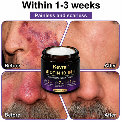 Made and Shipped from USA✨Kevrai® Biotin 10-in-1 Skin Restoration Cream🍀